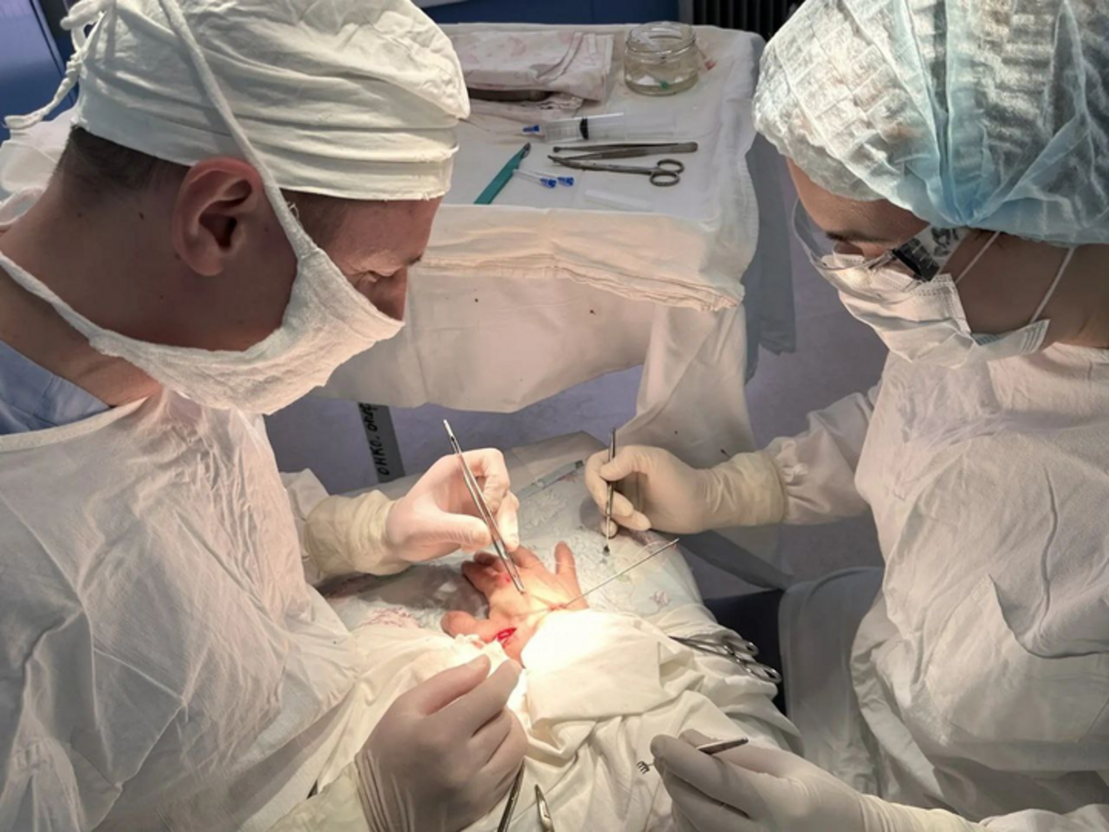 В Октябрьском сделали уникальную операцию на кисти