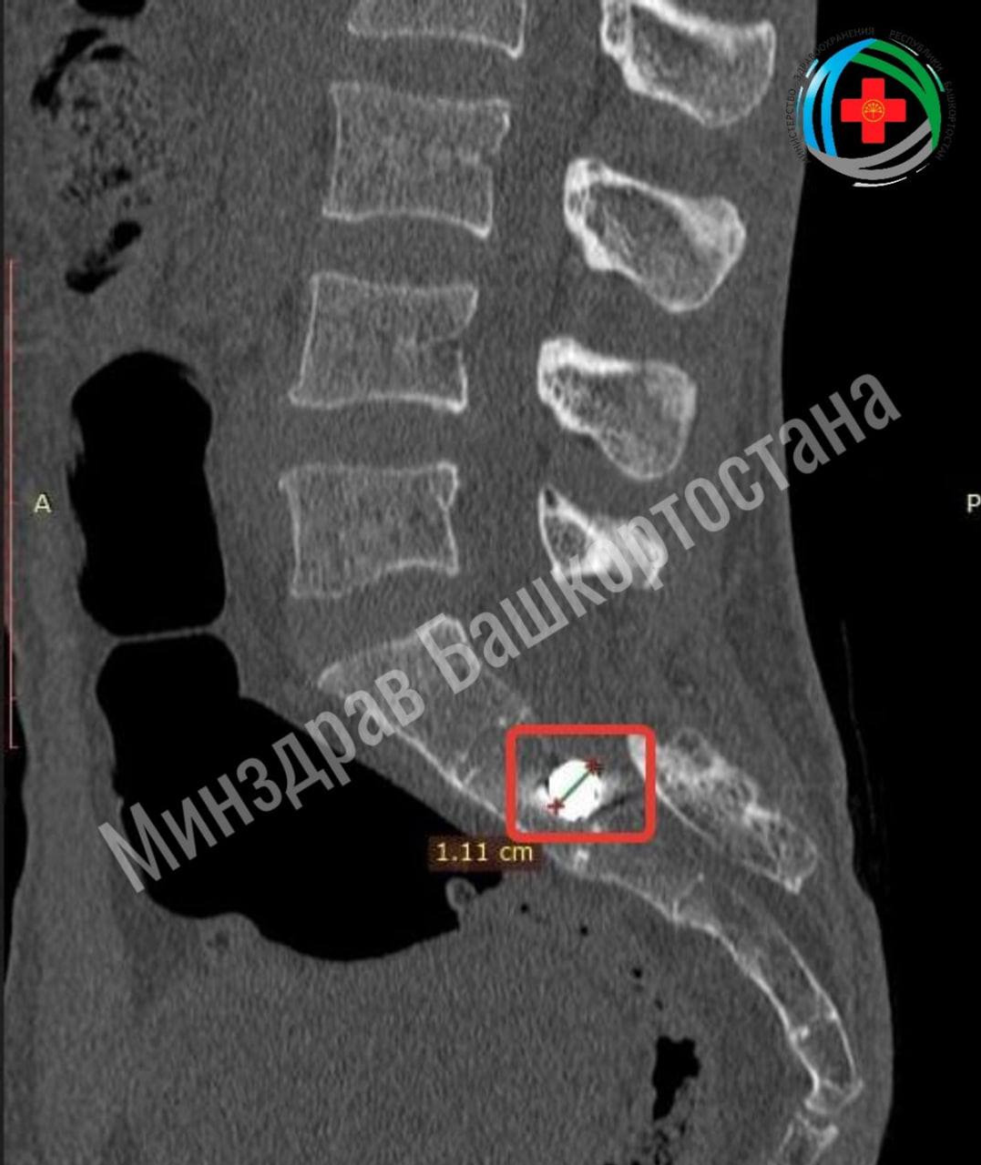 Минздрава РБ